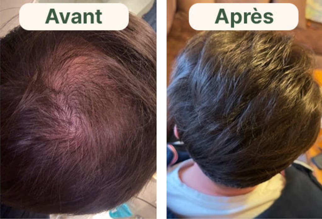 Kit Renouvellement Capillaire (FR)